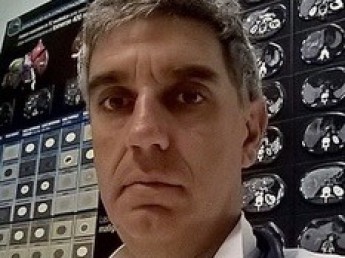 Francesco